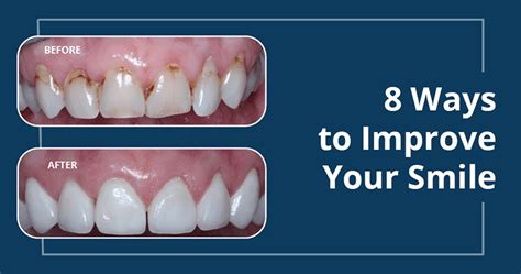 5 Ways University Smiles Dental Improves Your Smile