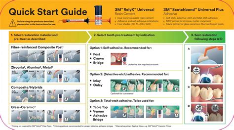 Relyx Universal Instructions: A Step-By-Step Guide