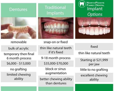 University Of Michigan Dental Implant Cost And Options